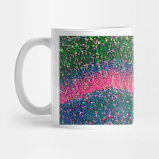 Hippocampus brain tissue (P360/0475) Mug